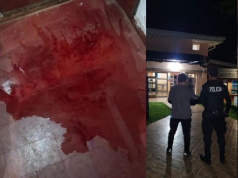“La casa era un charco de sangre”: detuvieron a un policía por una brutal paliza a su esposa en San Martín