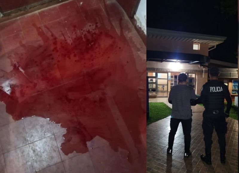 “La casa era un charco de sangre”: detuvieron a un policía por una brutal paliza a su esposa en San Martín